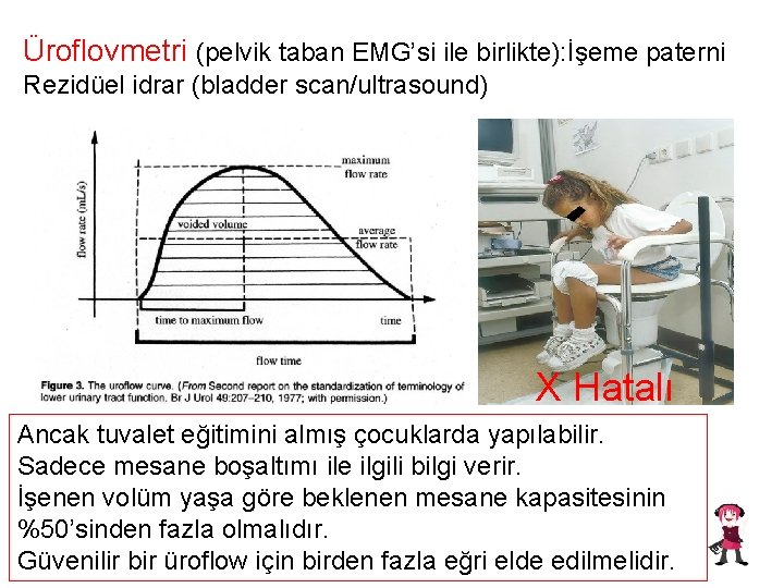 Üroflovmetri (pelvik taban EMG’si ile birlikte): İşeme paterni Rezidüel idrar (bladder scan/ultrasound) X Hatalı