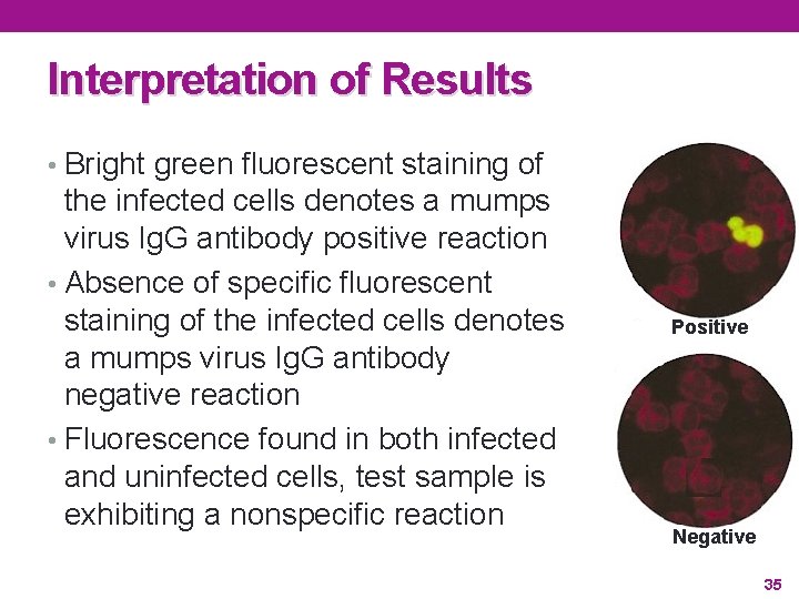 Interpretation of Results • Bright green fluorescent staining of the infected cells denotes a