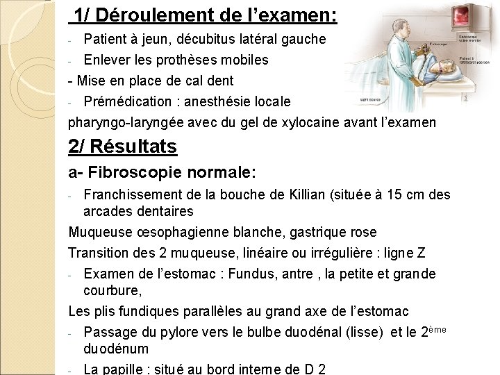 1/ Déroulement de l’examen: - Patient à jeun, décubitus latéral gauche Enlever les prothèses