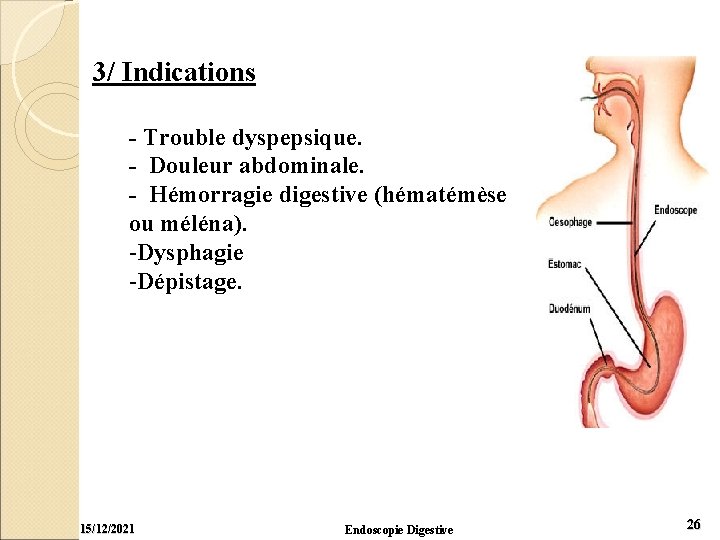 3/ Indications - Trouble dyspepsique. - Douleur abdominale. - Hémorragie digestive (hématémèse ou méléna).