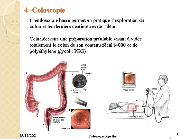 4 -Coloscopie L’endoscopie basse permet en pratique l’exploration du colon et les derniers centimètres