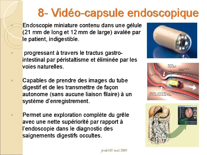 8 - Vidéo-capsule endoscopique ◦ Endoscopie miniature contenu dans une gélule (21 mm de