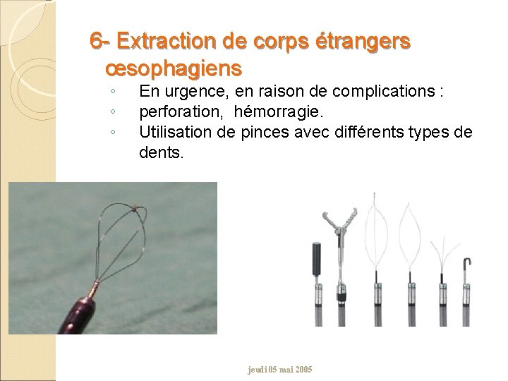 6 - Extraction de corps étrangers œsophagiens ◦ ◦ ◦ En urgence, en raison