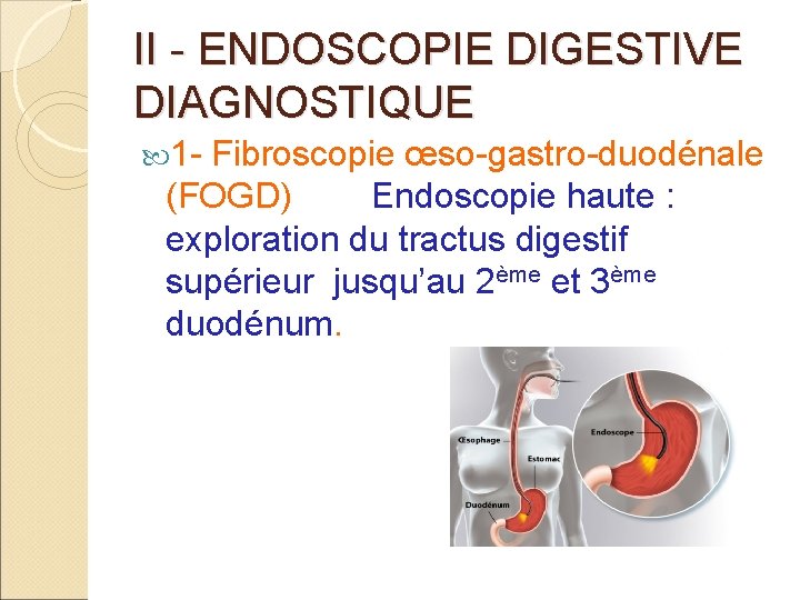 II - ENDOSCOPIE DIGESTIVE DIAGNOSTIQUE 1 - Fibroscopie œso-gastro-duodénale (FOGD) Endoscopie haute : exploration