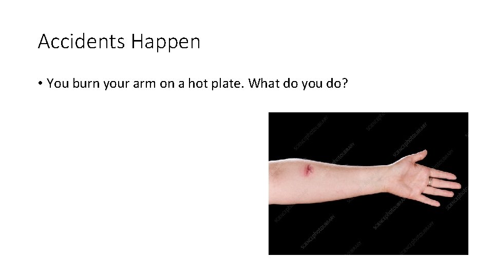 Accidents Happen • You burn your arm on a hot plate. What do you