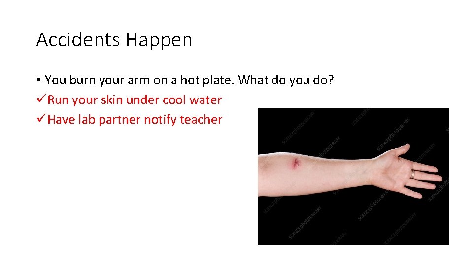 Accidents Happen • You burn your arm on a hot plate. What do you