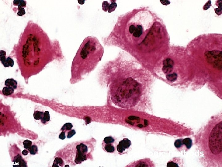 cytologic methods Slide 8. 56 