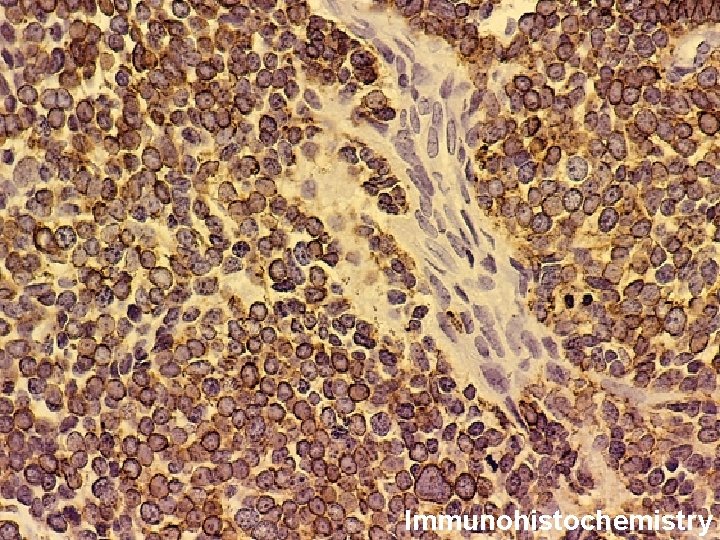 Immunohistochemistry 