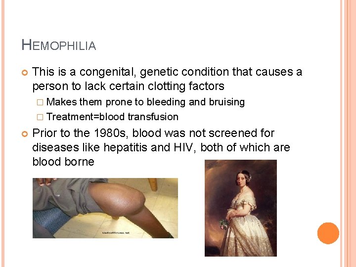 HEMOPHILIA This is a congenital, genetic condition that causes a person to lack certain