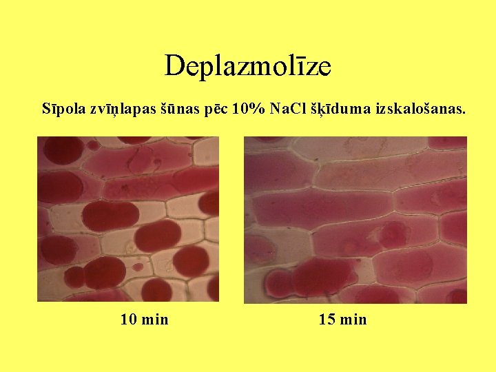 Deplazmolīze Sīpola zvīņlapas šūnas pēc 10% Na. Cl šķīduma izskalošanas. 10 min 15 min