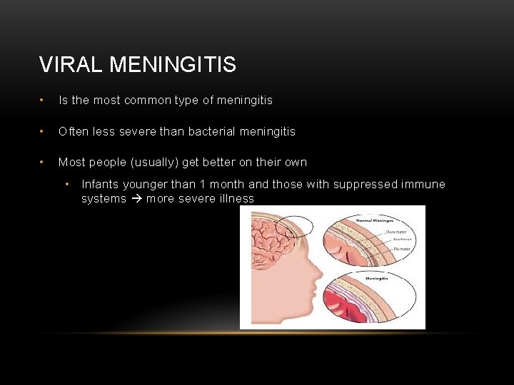 VIRAL MENINGITIS • Is the most common type of meningitis • Often less severe