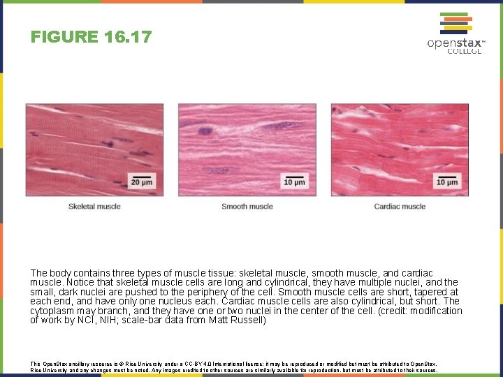 FIGURE 16. 17 The body contains three types of muscle tissue: skeletal muscle, smooth