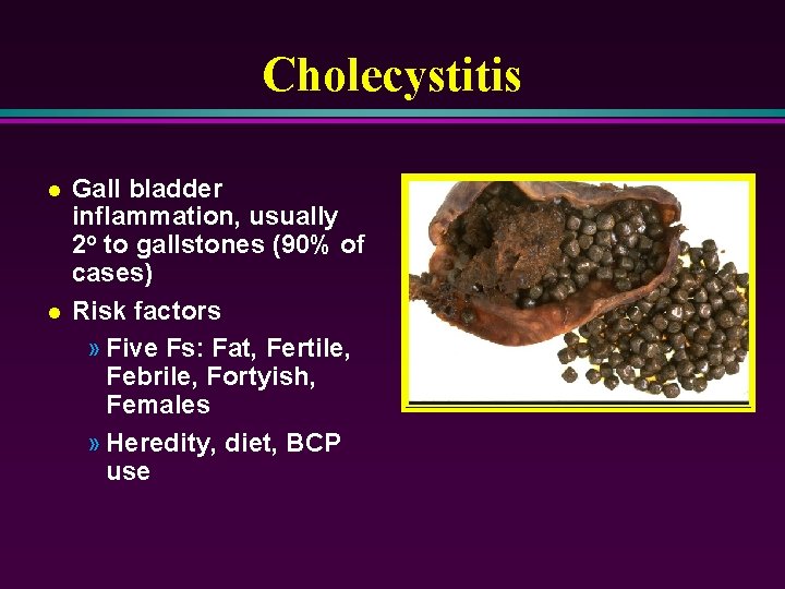 Cholecystitis l l Gall bladder inflammation, usually 2 o to gallstones (90% of cases)