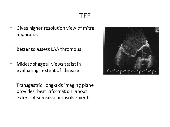 TEE • Gives higher resolution view of mitral apparatus • Better to assess LAA
