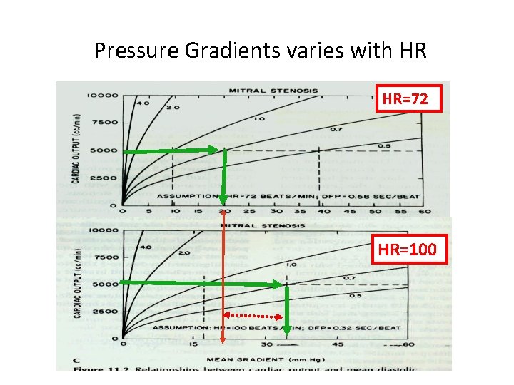 Pressure Gradients varies with HR HR=72 HR=100 