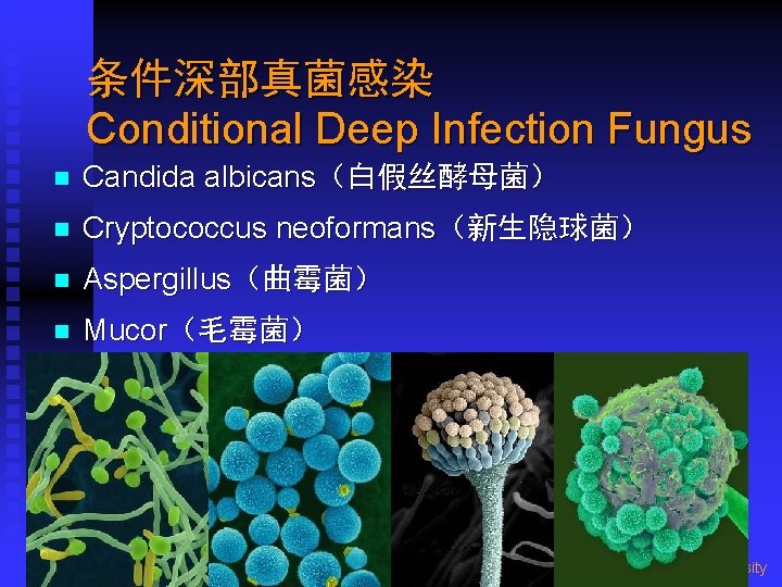 条件深部真菌感染 Conditional Deep Infection Fungus n Candida albicans（白假丝酵母菌） n Cryptococcus neoformans（新生隐球菌） n Aspergillus（曲霉菌） n