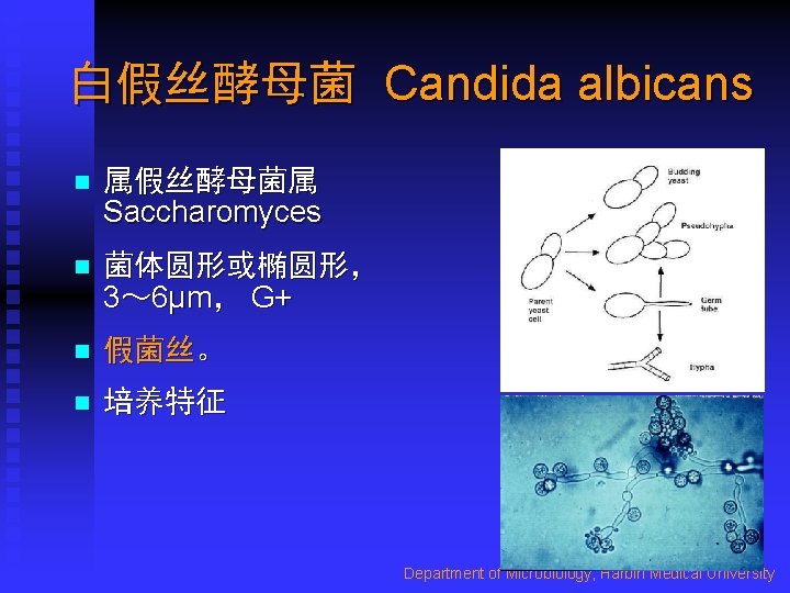 白假丝酵母菌 Candida albicans n 属假丝酵母菌属 Saccharomyces n 菌体圆形或椭圆形， 3～ 6μm， G+ n 假菌丝。 n