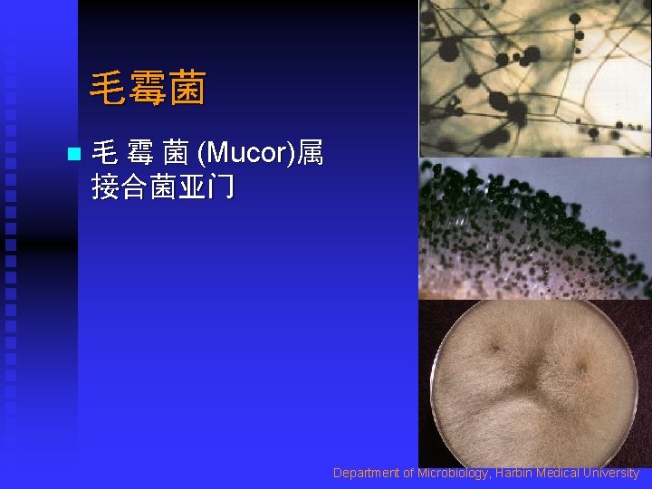 毛霉菌 n 毛 霉 菌 (Mucor)属 接合菌亚门 Department of Microbiology, Harbin Medical University 