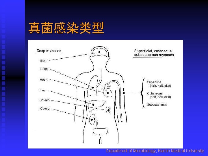 真菌感染类型 Department of Microbiology, Harbin Medical University 
