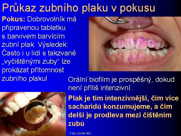 Průkaz zubního plaku v pokusu Pokus: Dobrovolník má připravenou tabletku s barvivem barvícím zubní