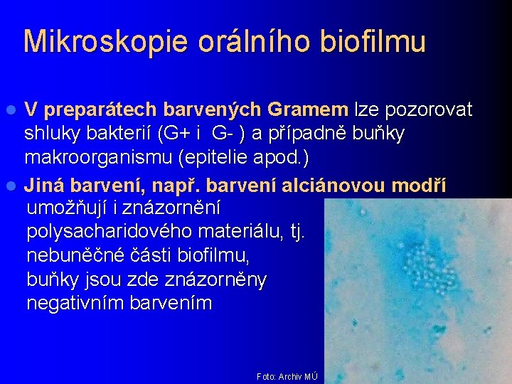 Mikroskopie orálního biofilmu V preparátech barvených Gramem lze pozorovat shluky bakterií (G+ i G-