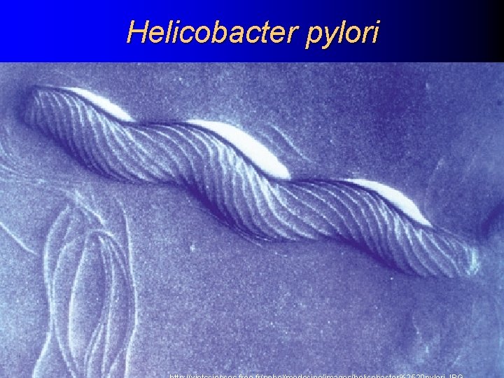 Helicobacter pylori 