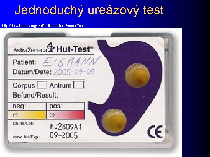 Jednoduchý ureázový test http: //de. wikipedia. org/wiki/Helicobacter-Urease-Test 