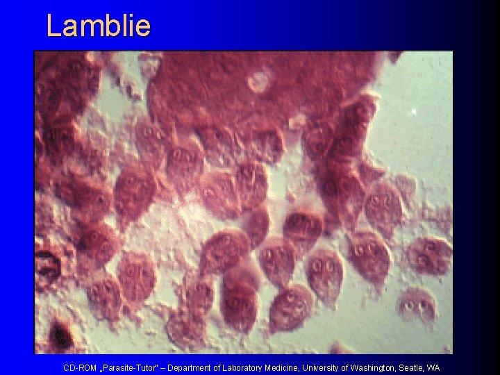 Lamblie CD-ROM „Parasite-Tutor“ – Department of Laboratory Medicine, University of Washington, Seatle, WA 