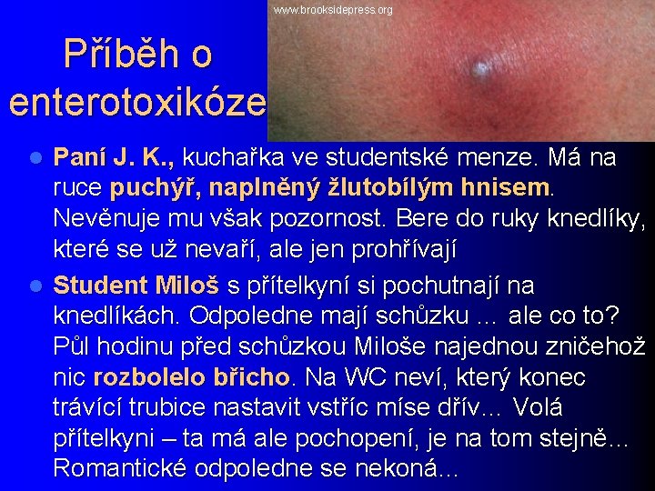 www. brooksidepress. org Příběh o enterotoxikóze Paní J. K. , kuchařka ve studentské menze.