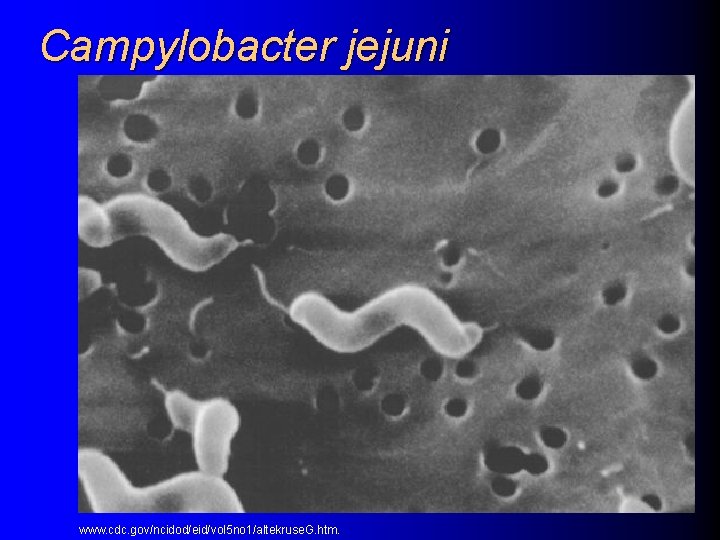 Campylobacter jejuni www. cdc. gov/ncidod/eid/vol 5 no 1/altekruse. G. htm. 