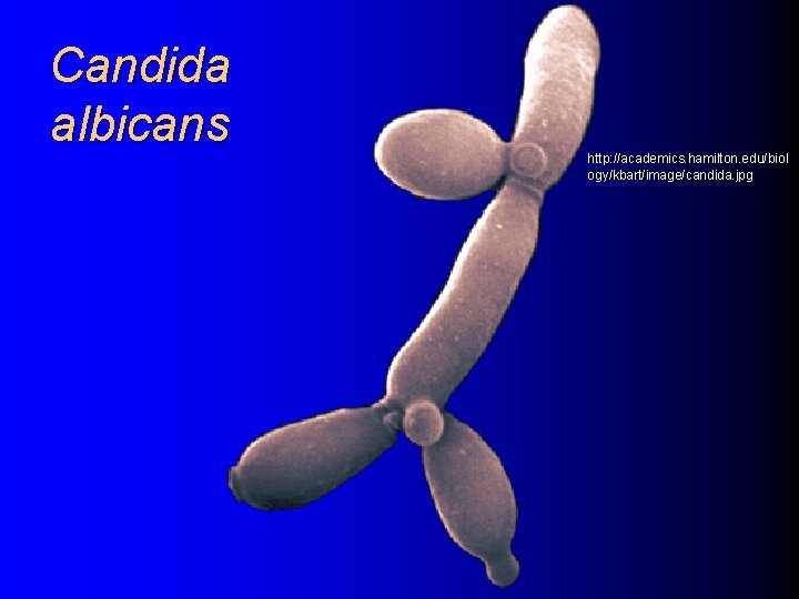 Candida albicans http: //academics. hamilton. edu/biol ogy/kbart/image/candida. jpg 