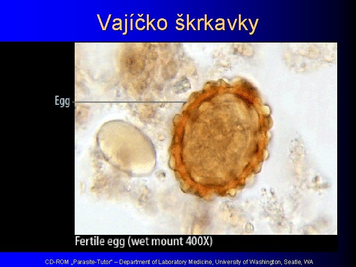 Vajíčko škrkavky CD-ROM „Parasite-Tutor“ – Department of Laboratory Medicine, University of Washington, Seatle, WA