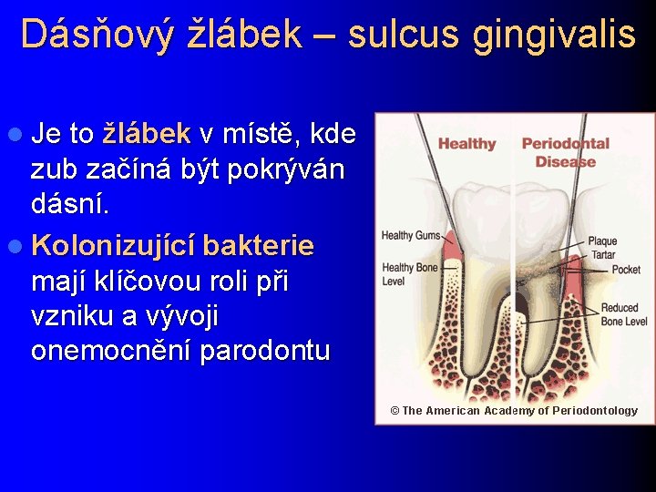 Dásňový žlábek – sulcus gingivalis l Je to žlábek v místě, kde zub začíná
