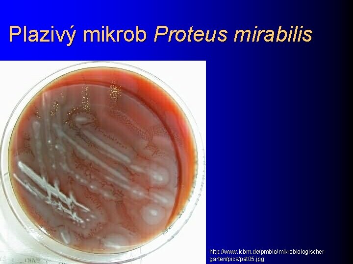 Plazivý mikrob Proteus mirabilis http: //www. icbm. de/pmbio/mikrobiologischergarten/pics/pat 05. jpg 