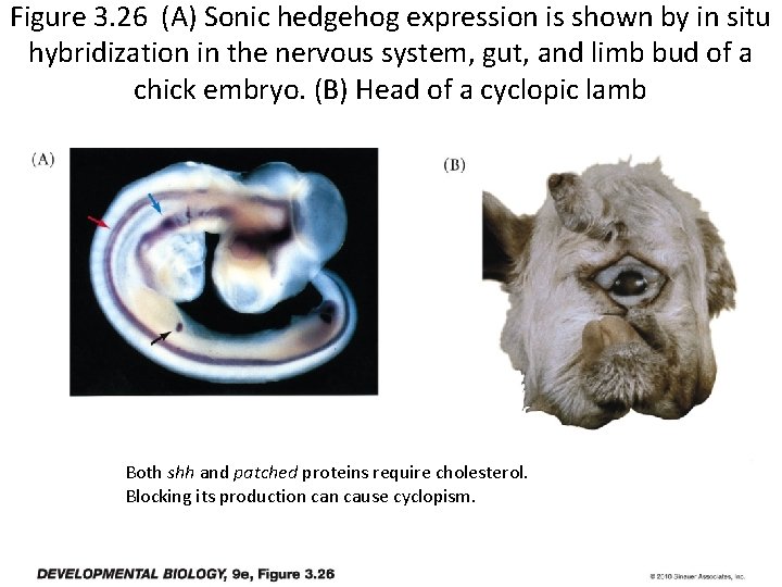 Figure 3. 26 (A) Sonic hedgehog expression is shown by in situ hybridization in