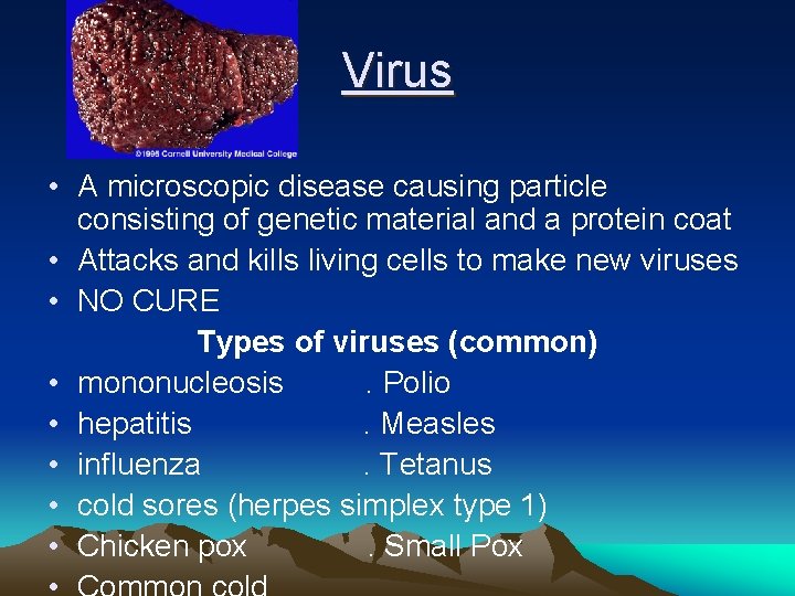 Virus • A microscopic disease causing particle consisting of genetic material and a protein