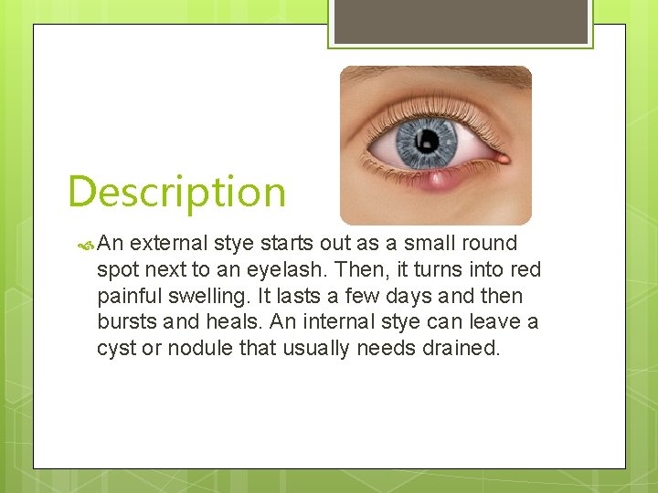 Description An external stye starts out as a small round spot next to an