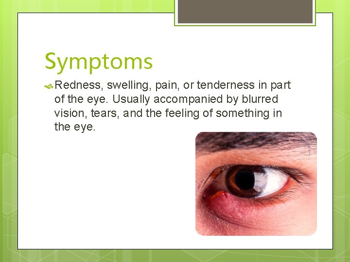 Symptoms Redness, swelling, pain, or tenderness in part of the eye. Usually accompanied by