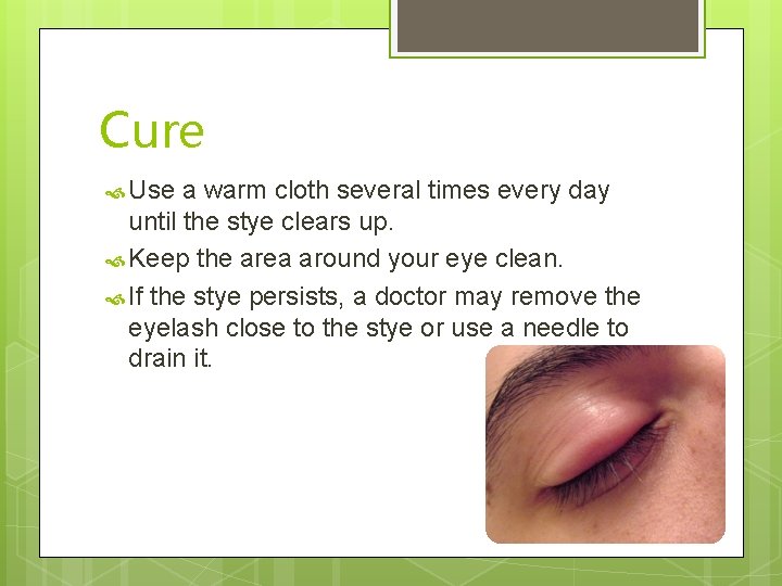 Cure Use a warm cloth several times every day until the stye clears up.