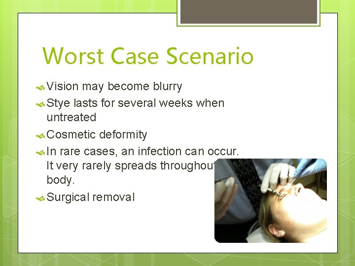 Worst Case Scenario Vision may become blurry Stye lasts for several weeks when untreated