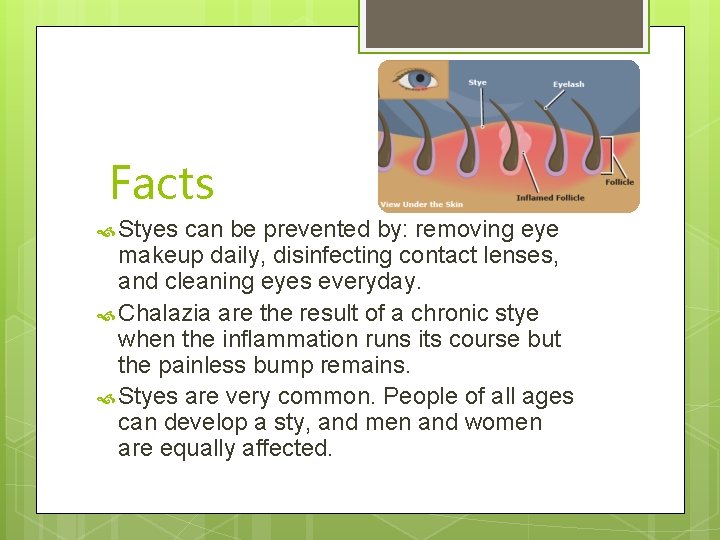 Facts Styes can be prevented by: removing eye makeup daily, disinfecting contact lenses, and