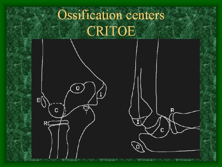 Ossification centers CRITOE 