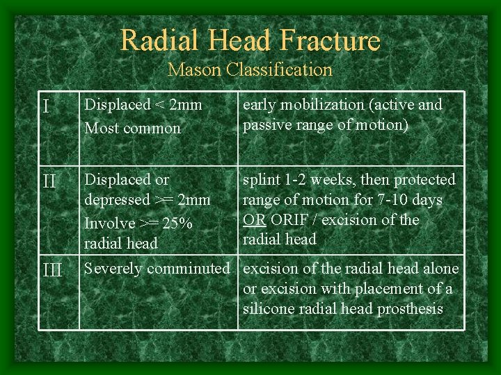 Radial Head Fracture Mason Classification I Displaced < 2 mm Most common early mobilization
