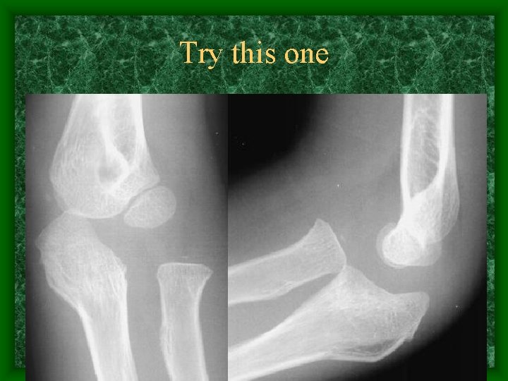 Try this one 