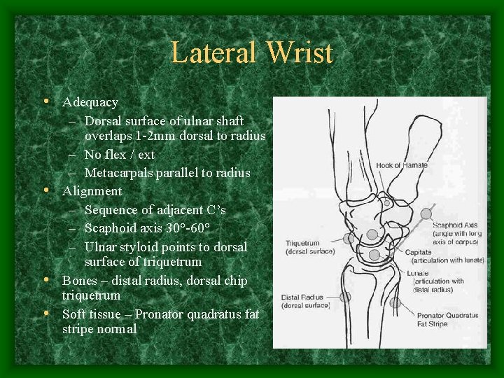 Lateral Wrist • Adequacy – Dorsal surface of ulnar shaft overlaps 1 -2 mm