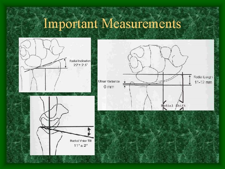 Important Measurements 