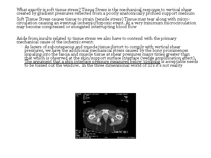 What exactly is soft tissue stress? Tissue Stress is the mechanical response to vertical