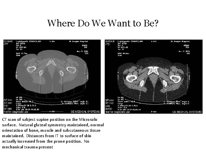 Where Do We Want to Be? CT scan of subject supine position on the