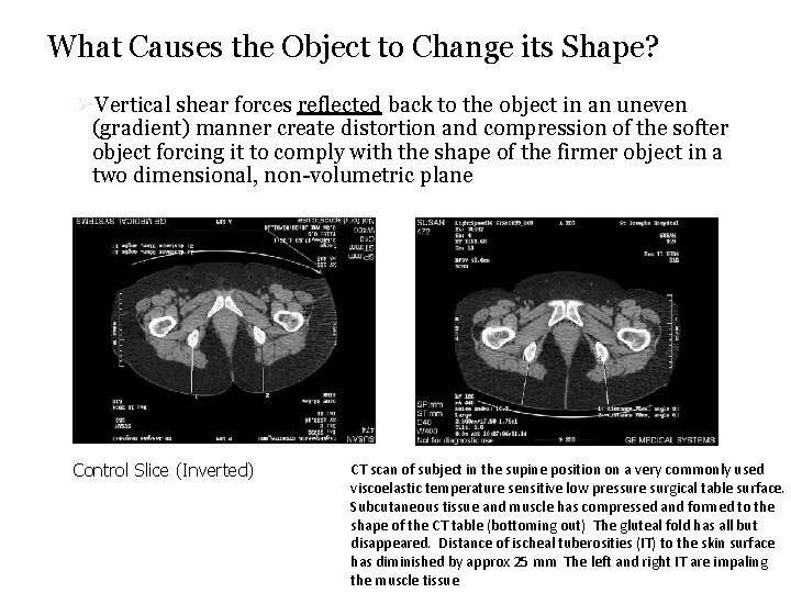 What Causes the Object to Change its Shape? ØVertical shear forces reflected back to