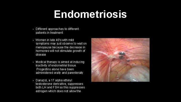 Endometriosis • Different approaches to different patients in treatment • Women in late 40's